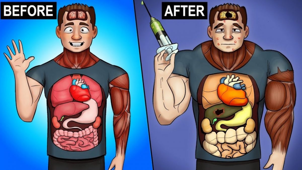 Steroids Before And After Results