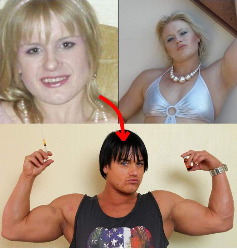 Steroid Abuse Women Result