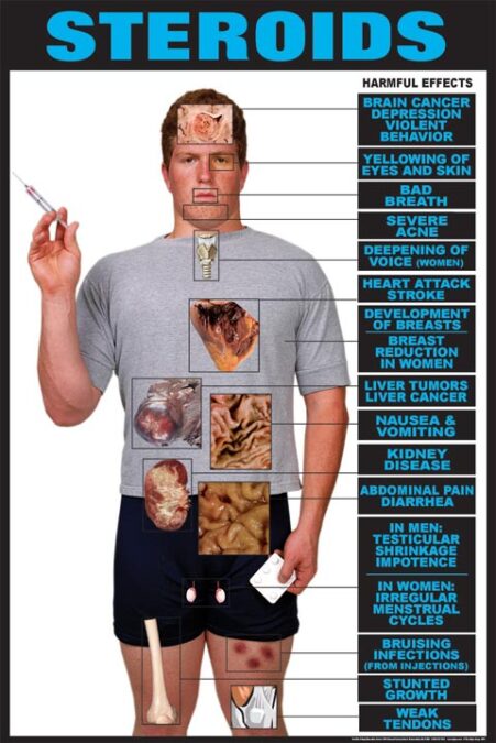 Steroid Abuse Chart