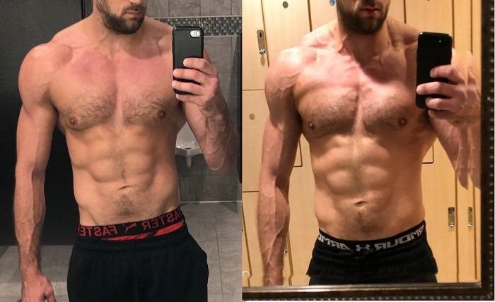 SARMs-and-Gyno-Results